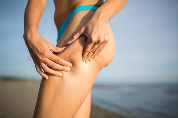 eliminare la cellulite